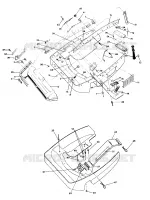 NOSEPAN SuperTrak (4921292129005A)